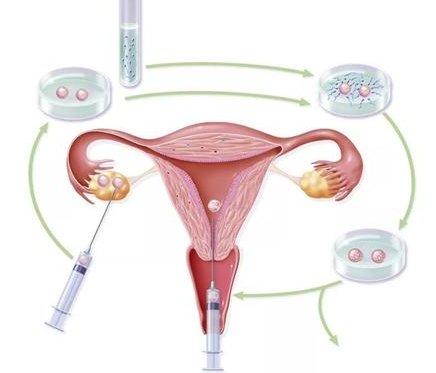 昆明九州医院做试管婴儿成功率有多高？